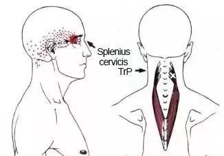 1,λ: ,¼Ⱥ(boccipital group) ¼ȺĴ
