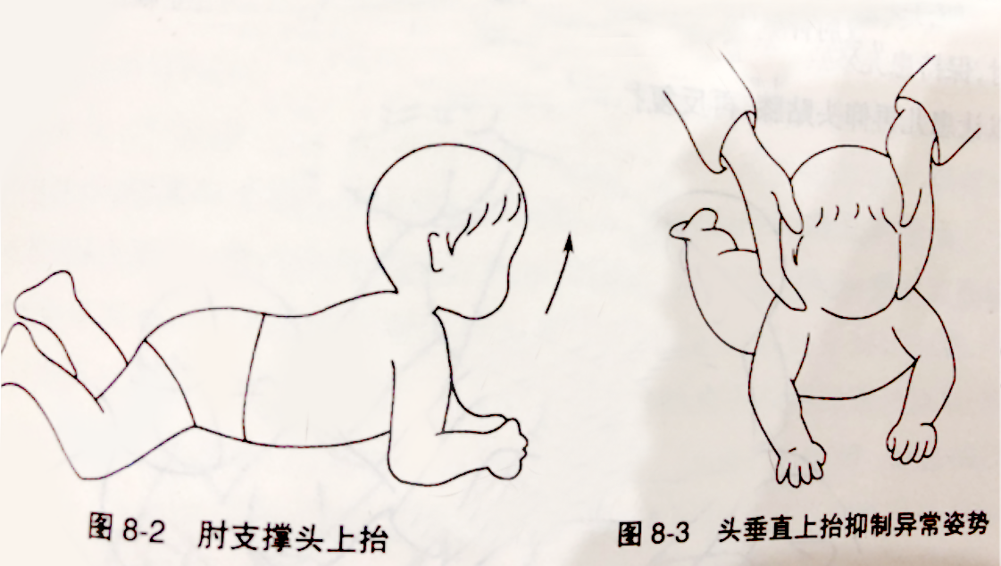 儿童康复医院|脑瘫患儿康复训练方法