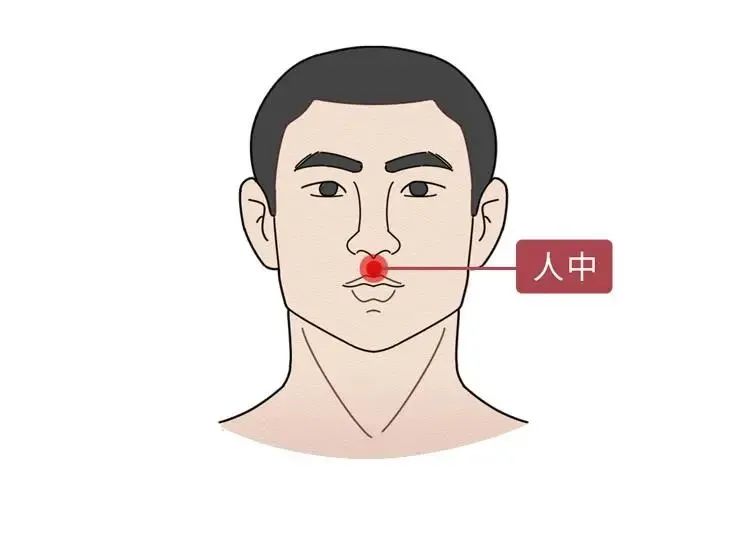 合肥康华康复医院|针灸穴位科普——人中穴
