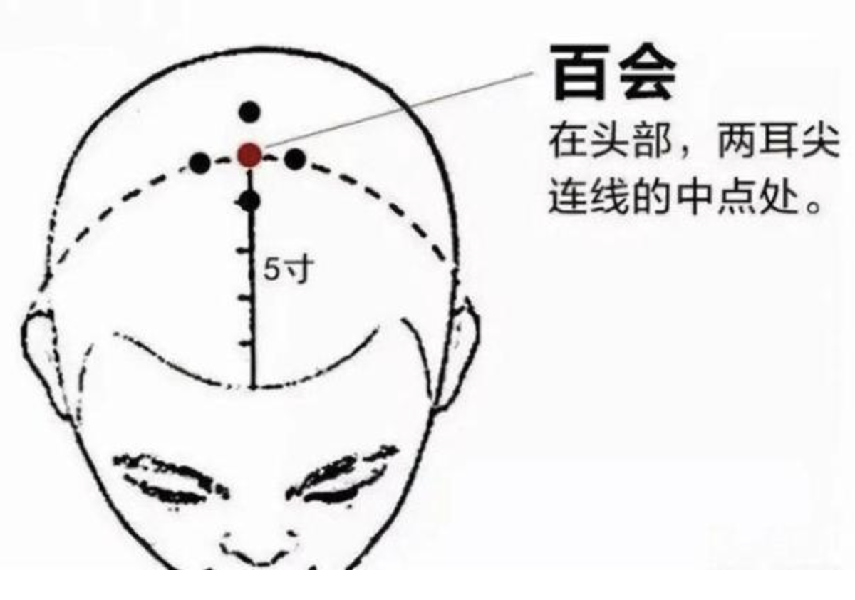 合肥康华康复医院|针灸穴位科普——百会穴