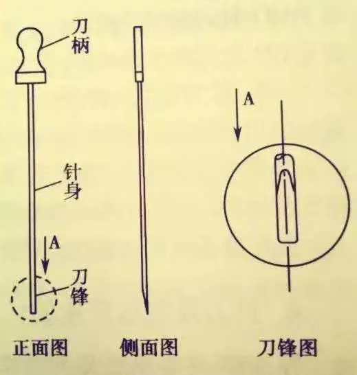 合肥康华康复医院——小针刀，作用大