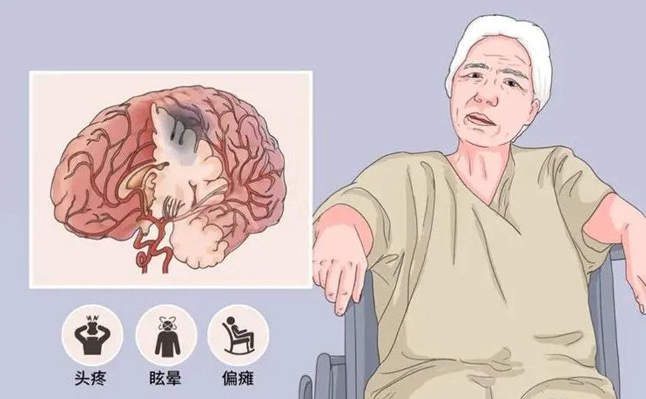 合肥康华康复医院|一图读懂脑卒中及其康复的相关知识