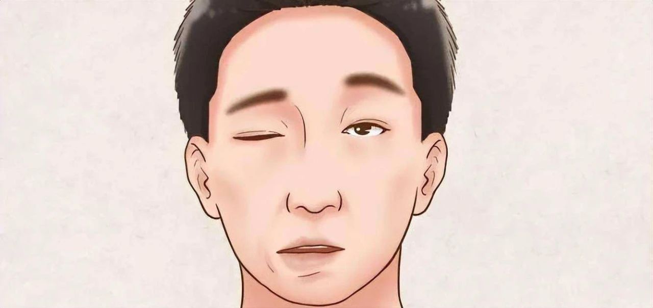 合肥康华康复医院|什么是面瘫？如何治疗？