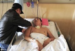 脑出血患者多数会留有哪些不同程度的后遗症症状