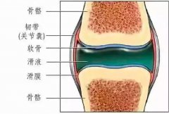 滑膜炎、滑囊炎、骨膜炎，都是什么？有什么症状？如何治疗？关节