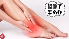 爸妈经常脚肿怎么办？如何用食疗消肿？按摩