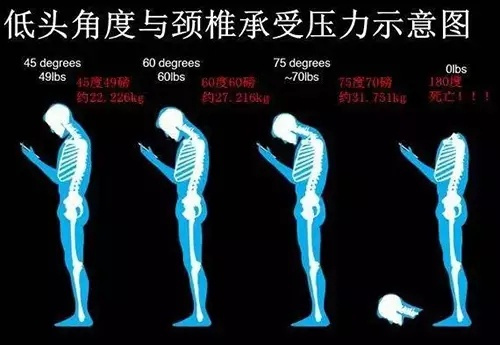 颈椎病的10个级别，看看你到第几级了？
