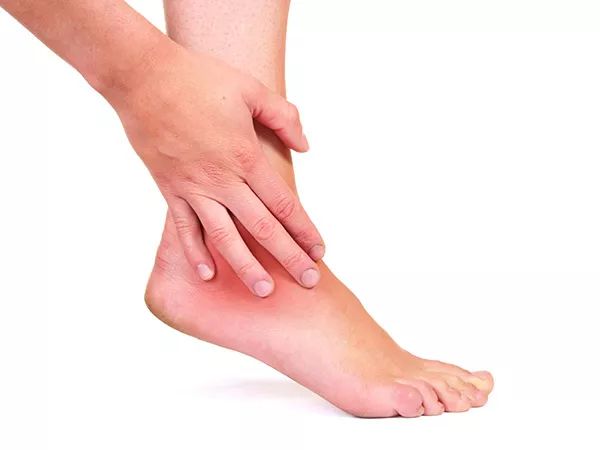 什么是跟腱炎,得了跟腱炎怎么办?黑金