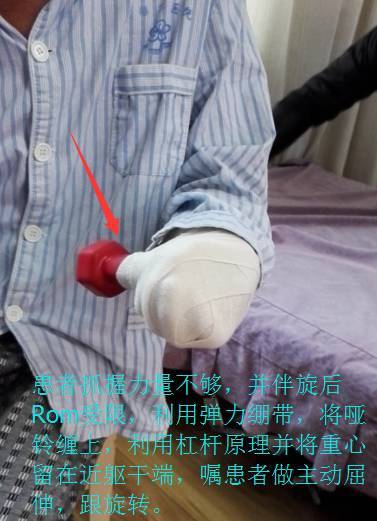 走进烧伤之-烧伤康复那些事儿！