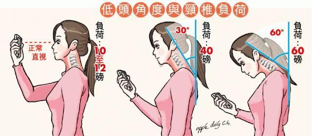 颈椎不好，性命难保！ 1分钟颈椎操，让颈椎不再僵硬！治疗