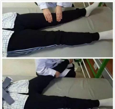 脑卒中康复训练不要忽视"膝过伸"(附:实用康复训练图解)膝关节