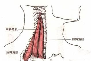 上交叉综合症的康复治疗策略肩胛