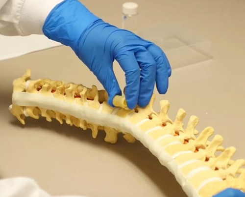 脊柱脊髓损伤病人不当搬运会引发严重后果