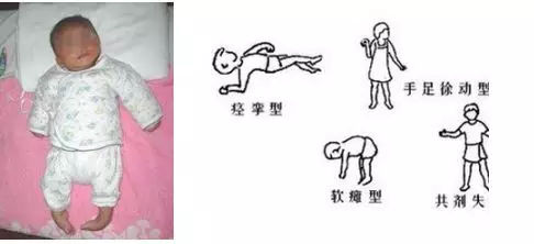 原来水疗对宝宝有这么多好处患儿