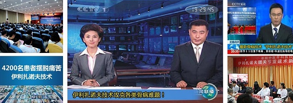 合肥康华康复医院引进伊利扎洛夫技术实现"手术+康复"