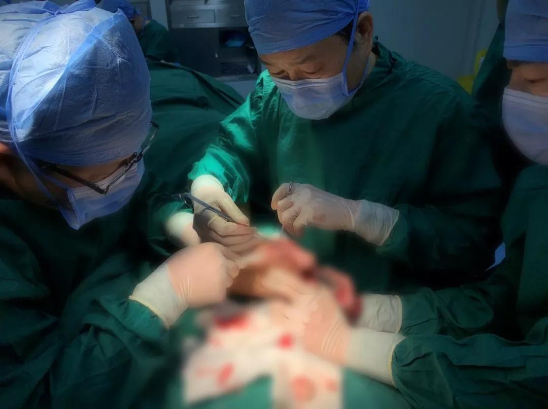 触目惊心!男子脚趾关节取出＂鹅蛋大＂的痛风石!