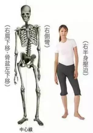 保护好脊柱，先学会避免下面不良动作……