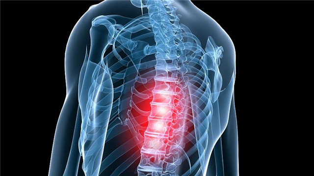 适合脊柱侧弯患者的锻炼方法有哪些？