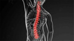 脊柱康复非手术治疗方式有哪些？