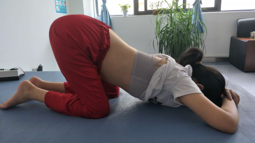 17岁少女的脊柱矫形变形记
