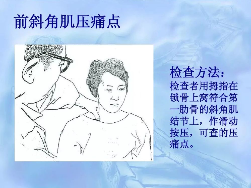 劳损性肌肉压痛点诊断检查法
