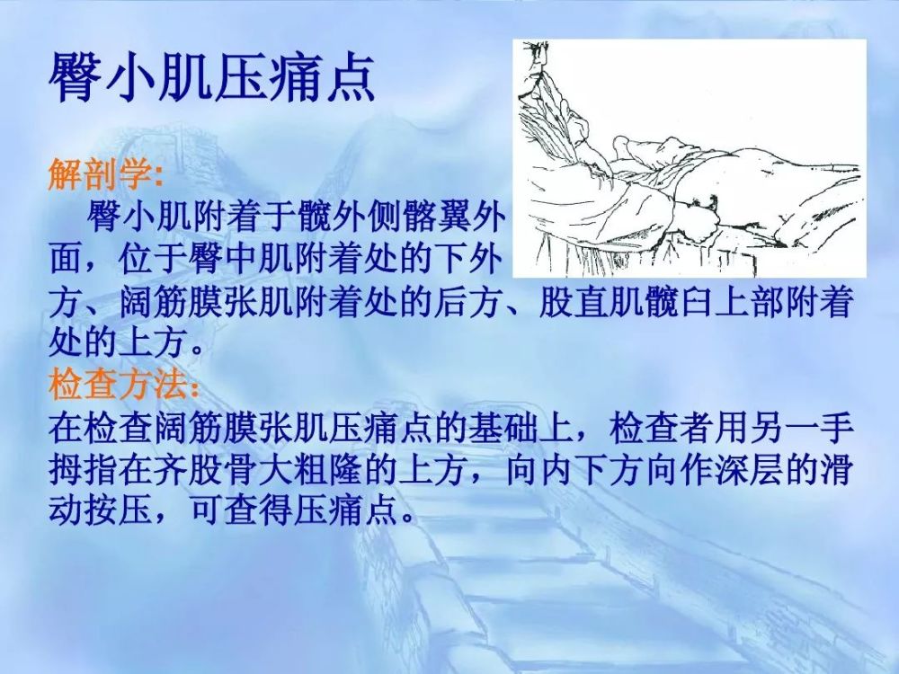 劳损性肌肉压痛点诊断检查法