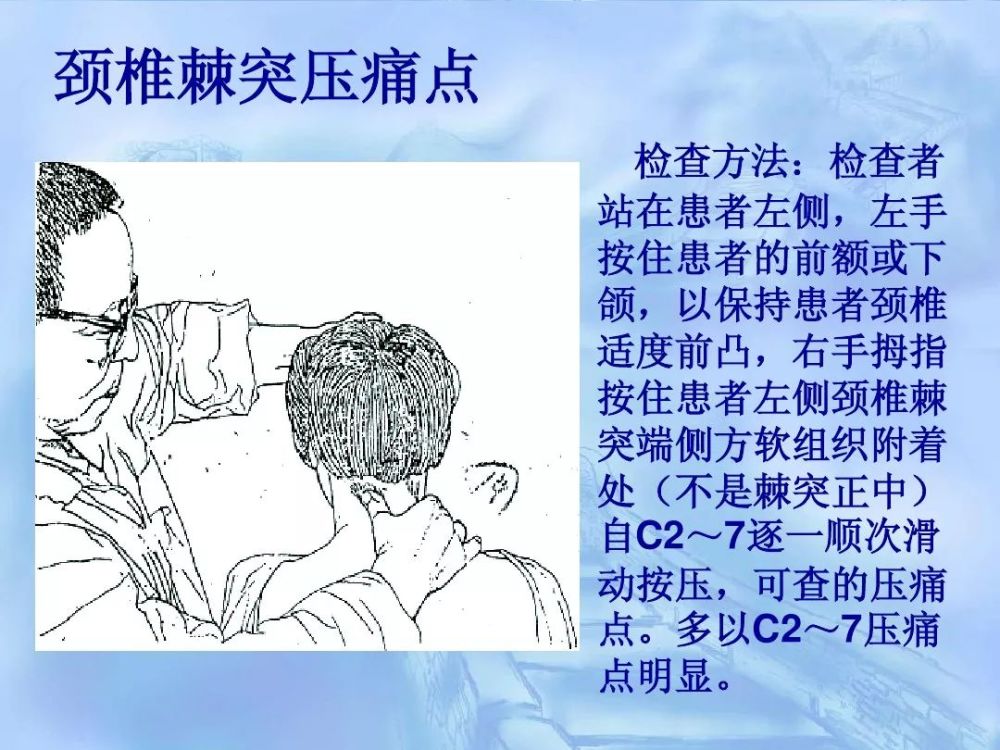 劳损性肌肉压痛点诊断检查法