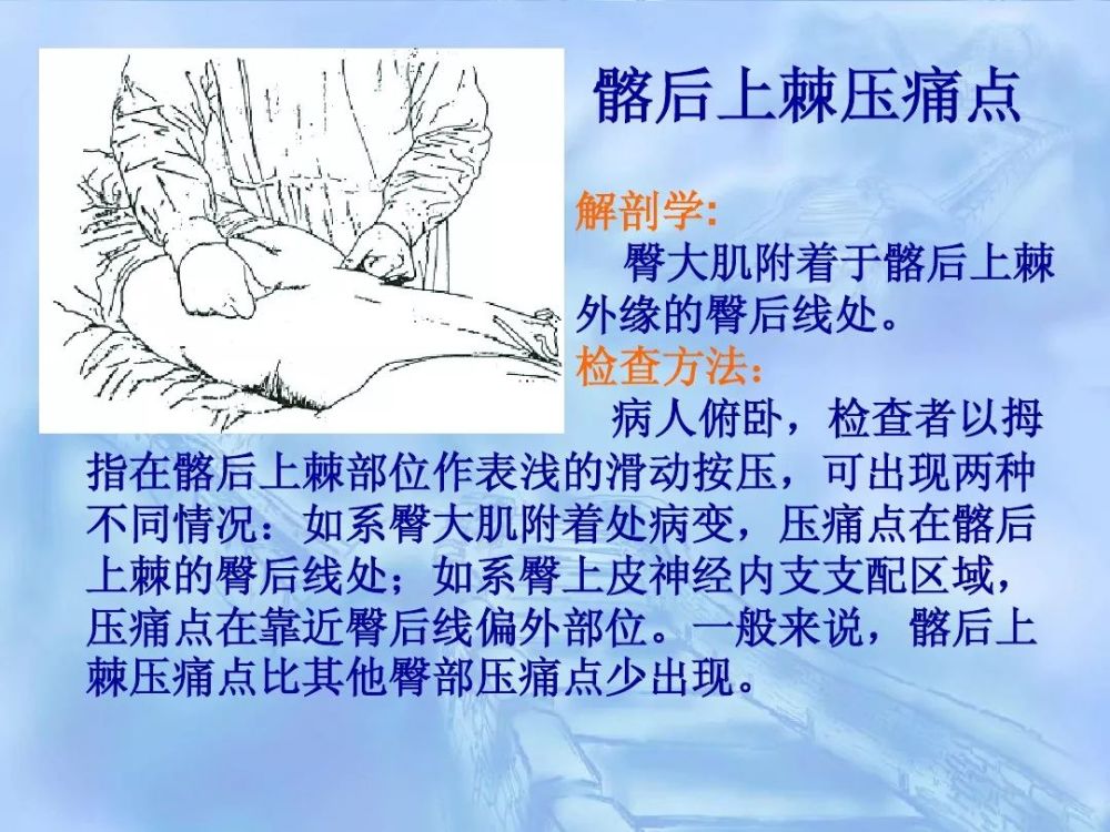 劳损性肌肉压痛点诊断检查法