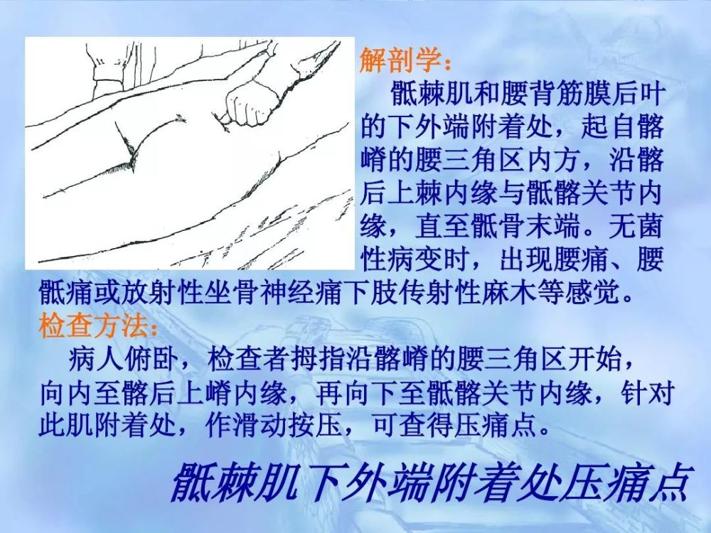 劳损性肌肉压痛点诊断检查法