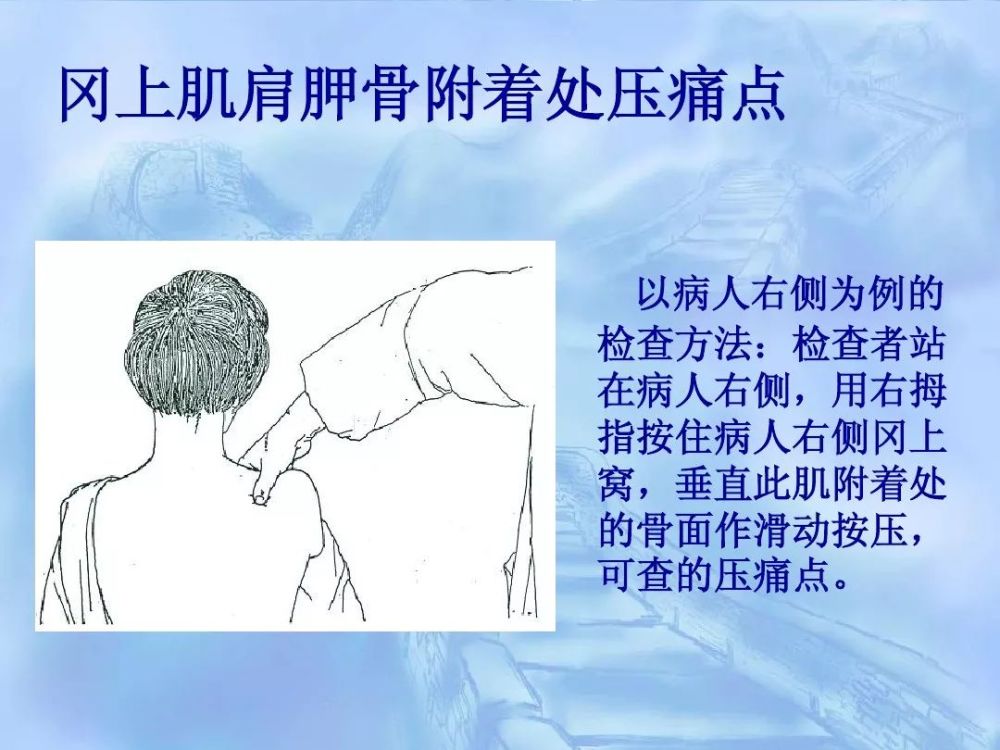 劳损性肌肉压痛点诊断检查法