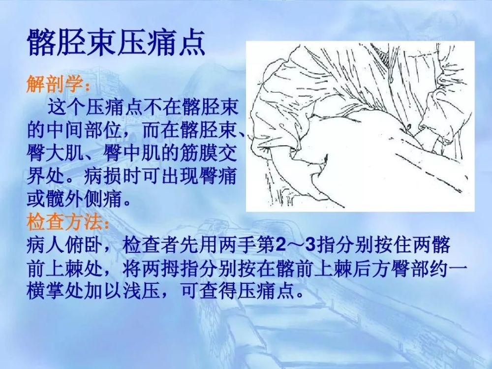 劳损性肌肉压痛点诊断检查法