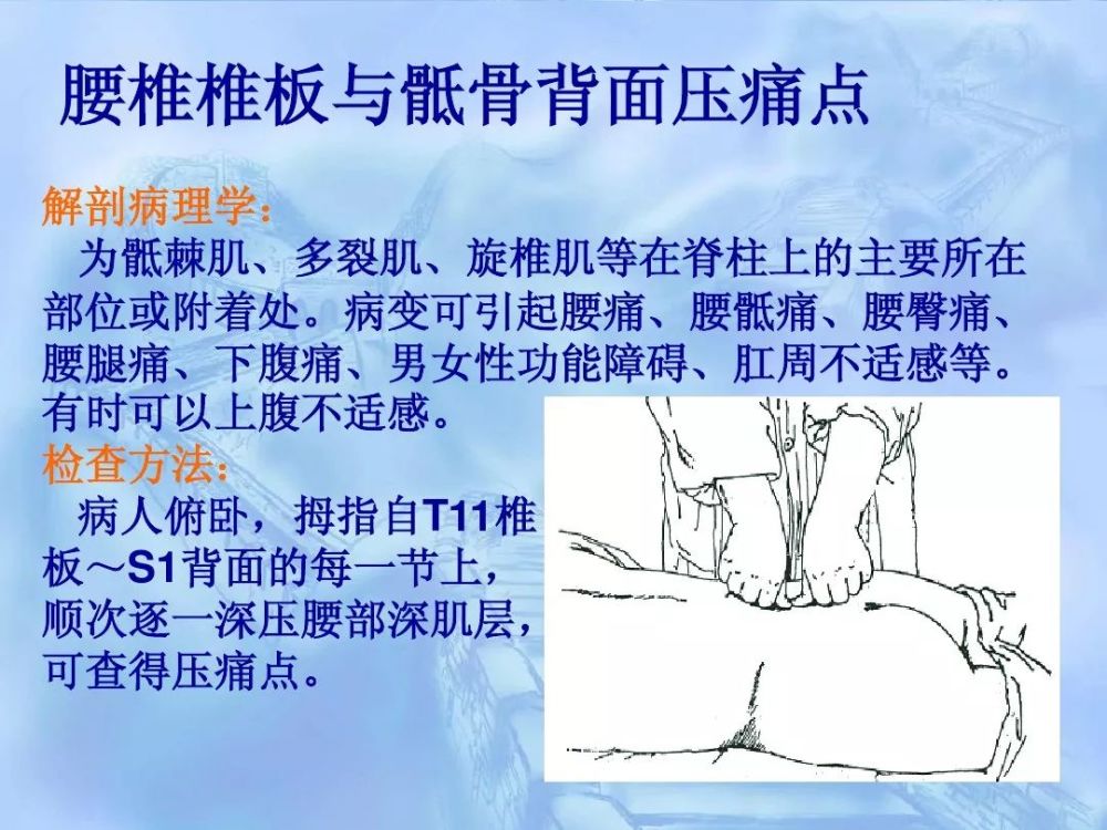 劳损性肌肉压痛点诊断检查法