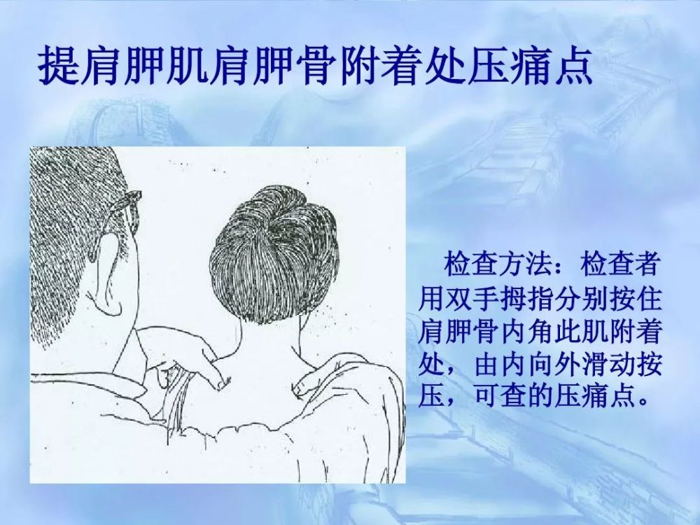 劳损性肌肉压痛点诊断检查法