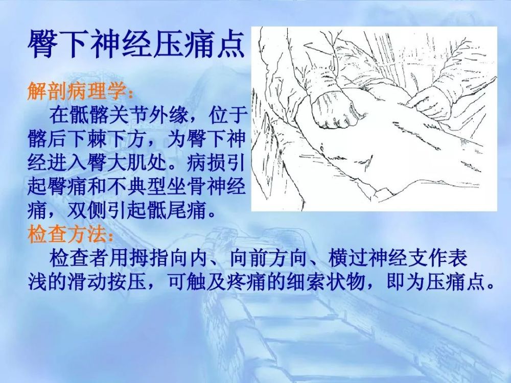 劳损性肌肉压痛点诊断检查法
