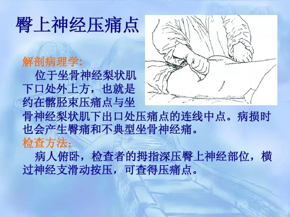 劳损性肌肉压痛点诊断检查法