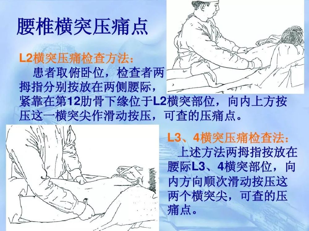 劳损性肌肉压痛点诊断检查法
