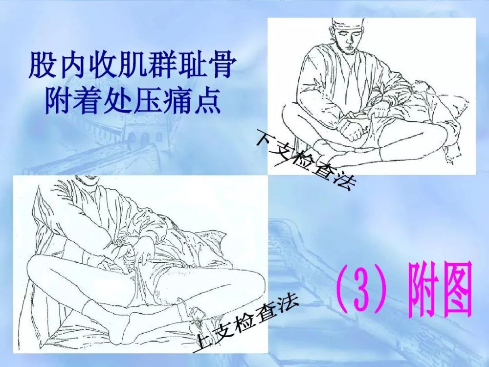 劳损性肌肉压痛点诊断检查法