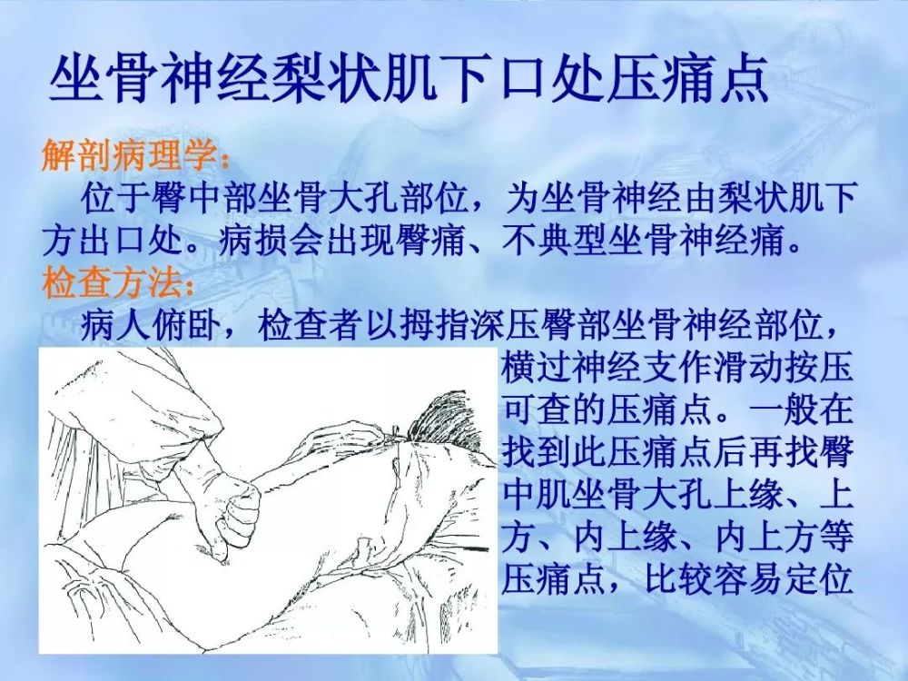 劳损性肌肉压痛点诊断检查法